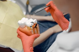 Model tooth dentist doctor shows patient tooth reception dentists office