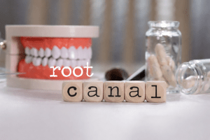 Root Canal